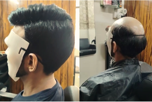 Hair patch transformation